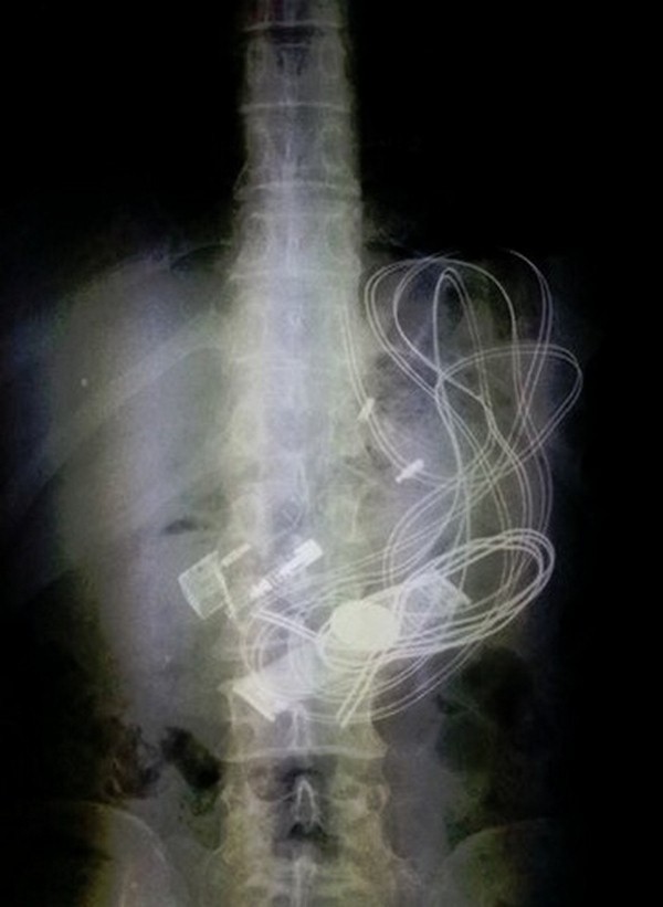 rendgenski snimak bolnica