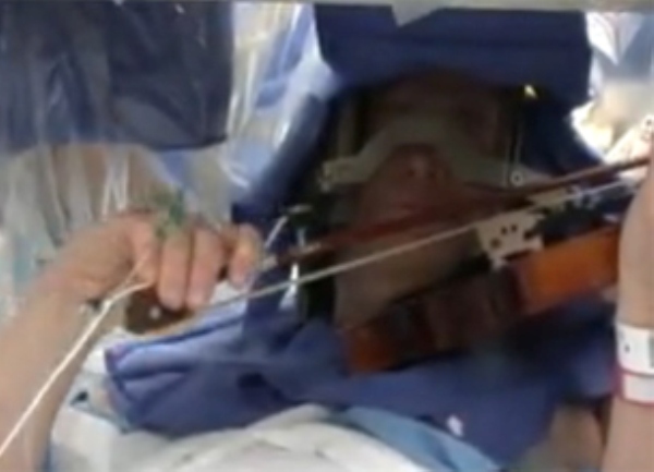 violina operacija