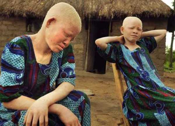 albino crnci albino crnci