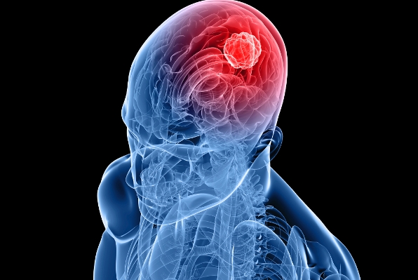 mozak-1000 mozak-1000