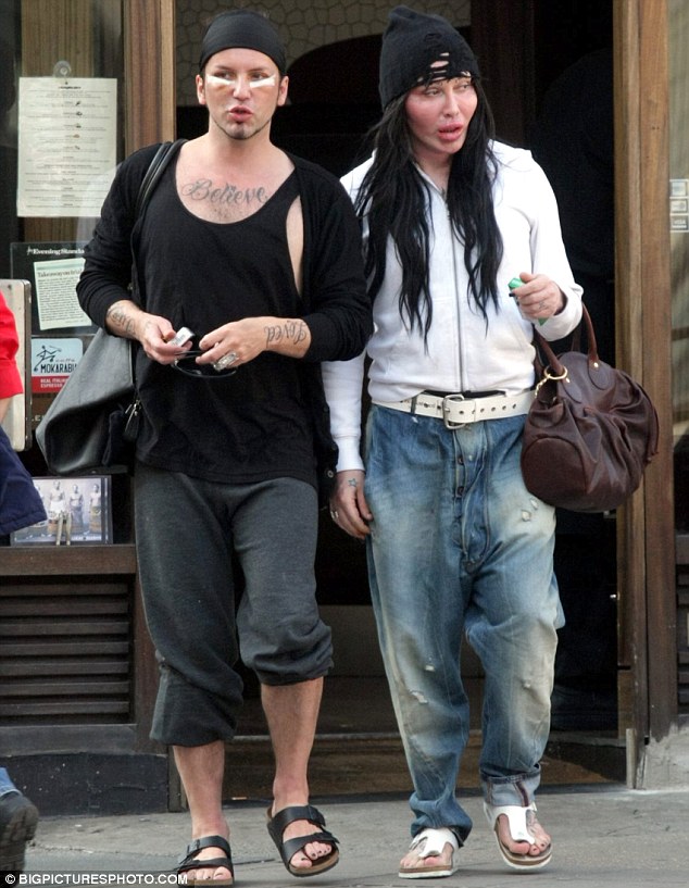 pete burns