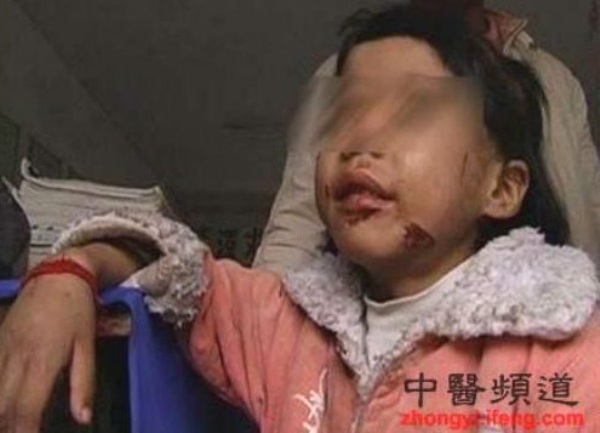 otac fekalijama napunio usta kćerke