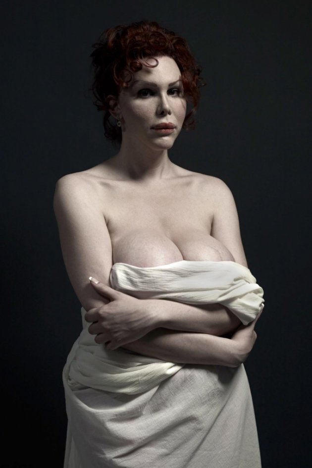 Portreti ekstremnih slučajeva plastične hirurgije