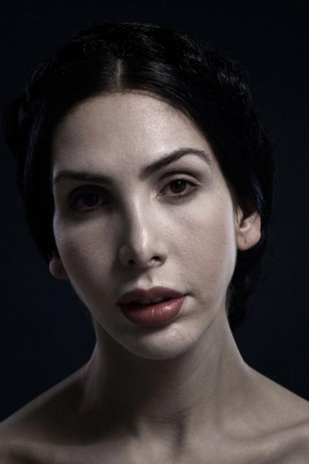 Portreti ekstremnih slučajeva plastične hirurgije