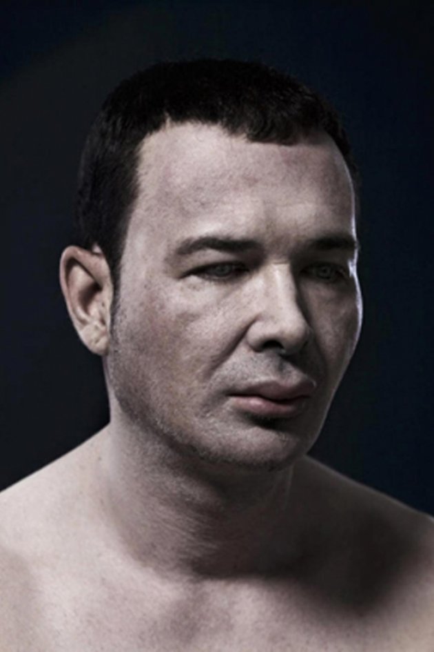 Portreti ekstremnih slučajeva plastične hirurgije