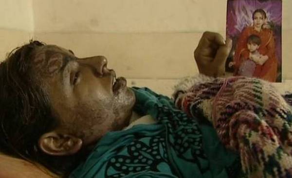 Ljepota i životi pakistanskih žena bivaju uni&scaron;teni u sekundi