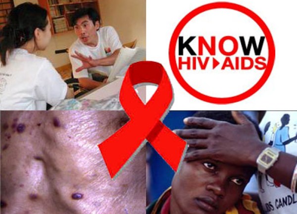 HIV AIDS