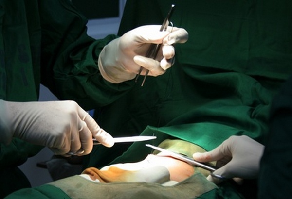 Hap&scaron;enje zbog nelegalnog presađivanja dijelova ljudskog tijela