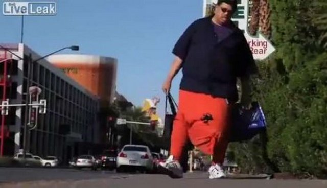 Pogledajte kako izgleda čovjek koji ima testise teške 45 kilograma Pogledajte kako izgleda čovjek koji ima testise teške 45 kilograma