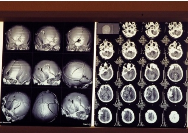 Dragan Do&scaron;en, foto: Nezavisne novine