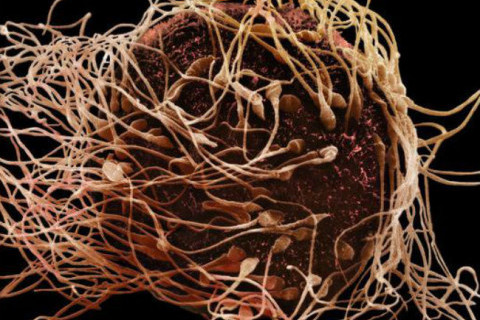 spermiji pod mikroskopom spermiji pod mikroskopom