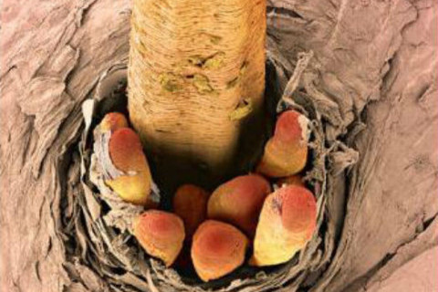 trepavice pod mikroskopom trepavice pod mikroskopom