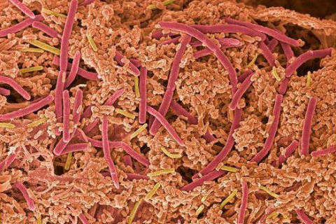 zubni plak pod mikroskopom zubni plak pod mikroskopom