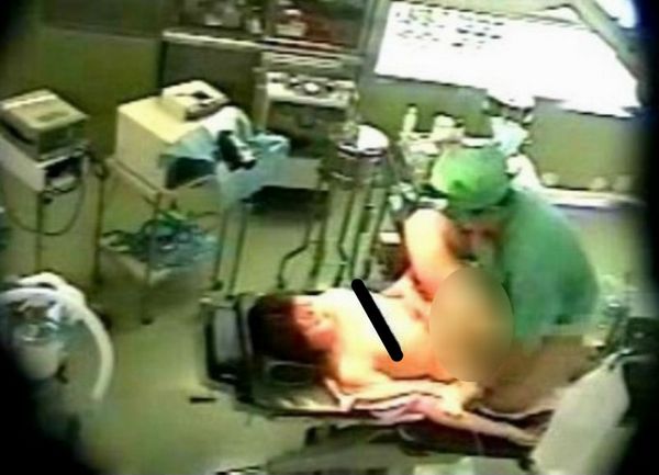 SILOVANJE ANESTEZIOLOG1