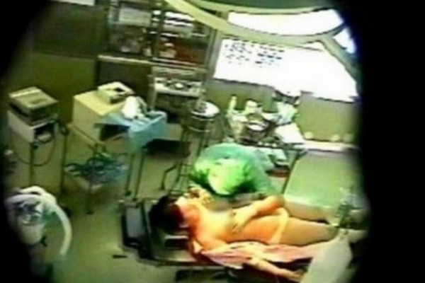 SILOVANJE ANESTEZIOLOG2