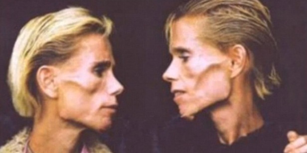 Clare i Rachel Wallmeyer