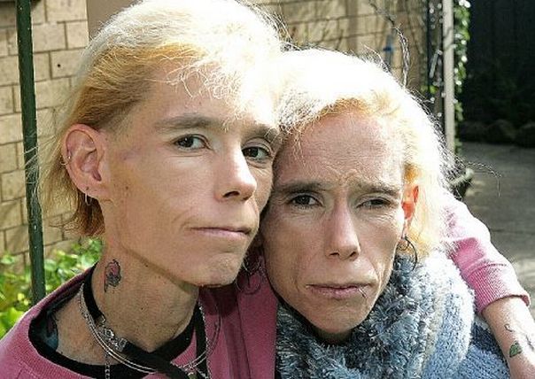 Clare i Rachel Wallmeyer