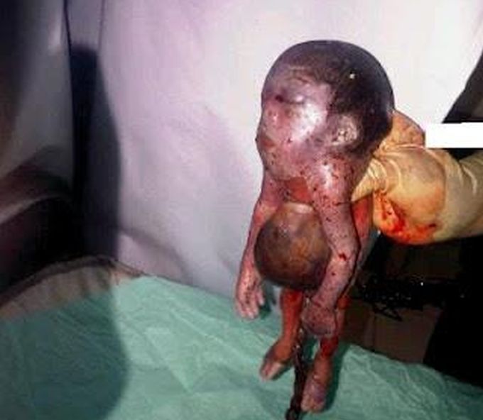 beba s kozijim nogama