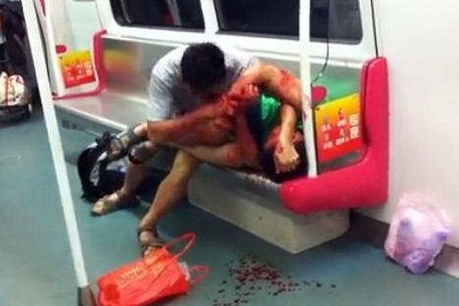 kinez izgrizao dječaka kinez izgrizao dječaka