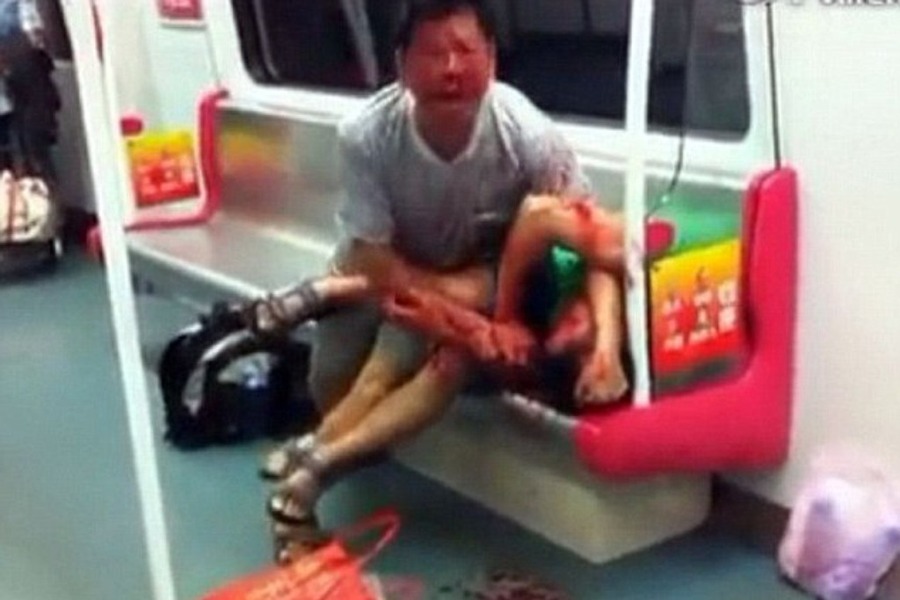 kinez izgrizao dječaka kinez izgrizao dječaka