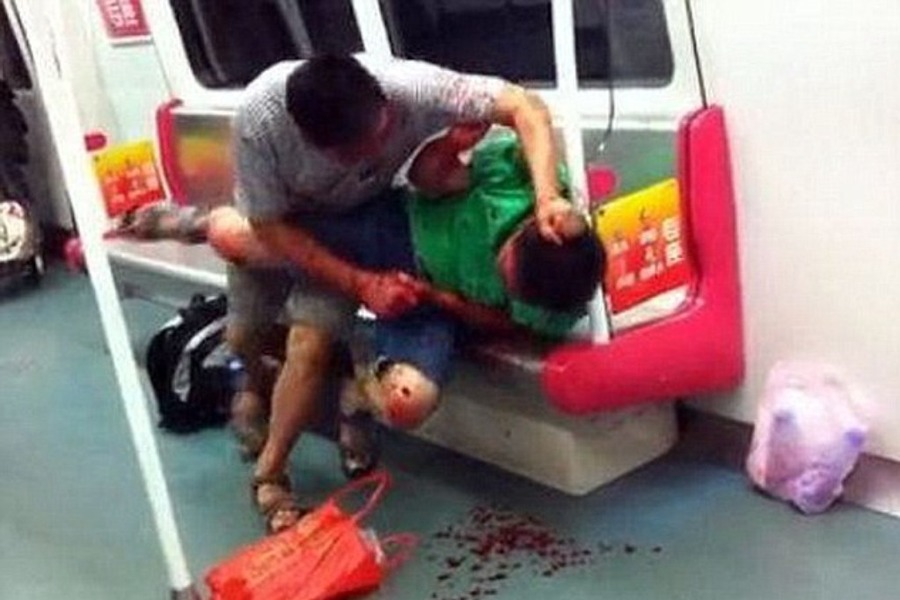 kinez izgrizao dječaka kinez izgrizao dječaka