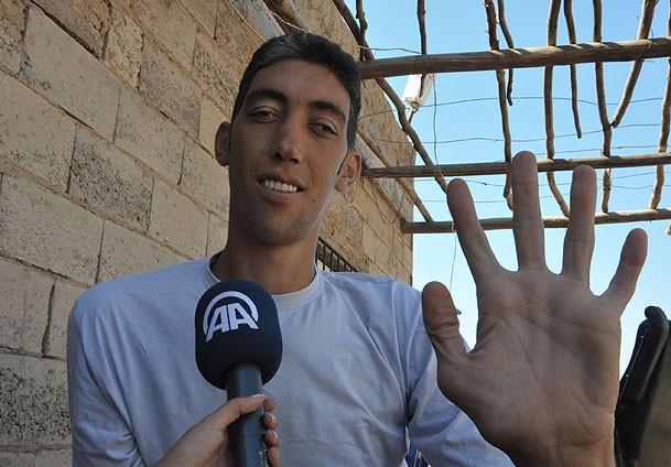 Najviši čovjek na svijetu prestao da raste Najviši čovjek na svijetu prestao da raste