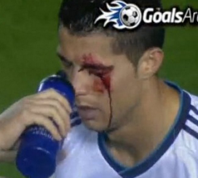 igrač Levantea razbio arkadu Cristianu Ronaldu