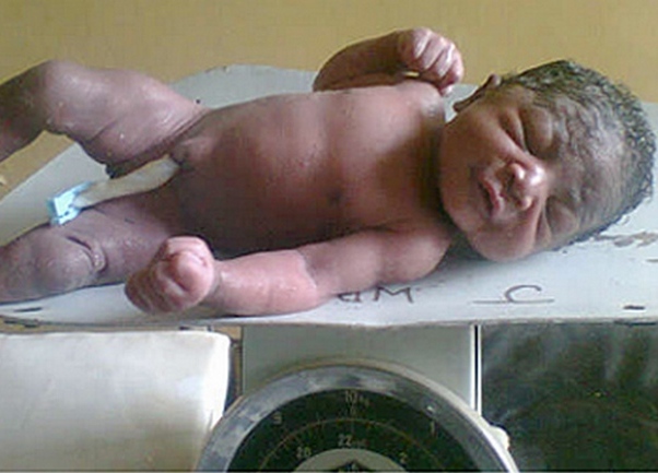 Beba živa zakopana Beba živa zakopana