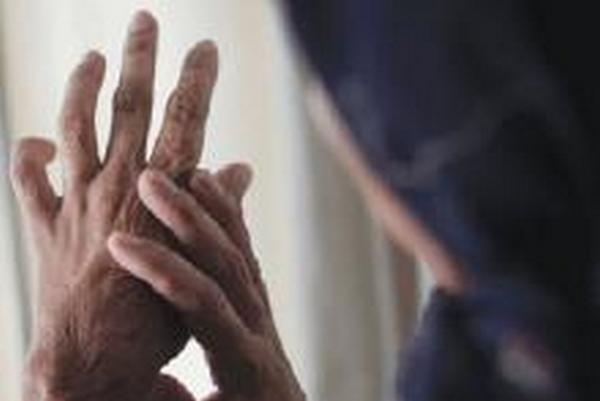 Kiselina opekline Kiselina opekline