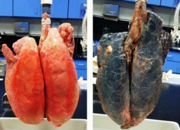 Pluća pu&scaron;ača