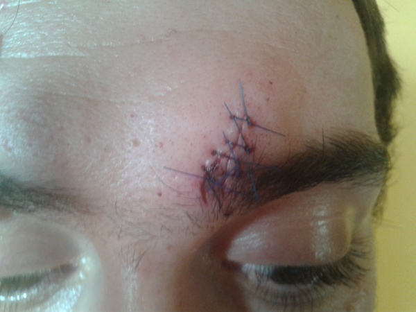 Posljedice protesta Posljedice protesta