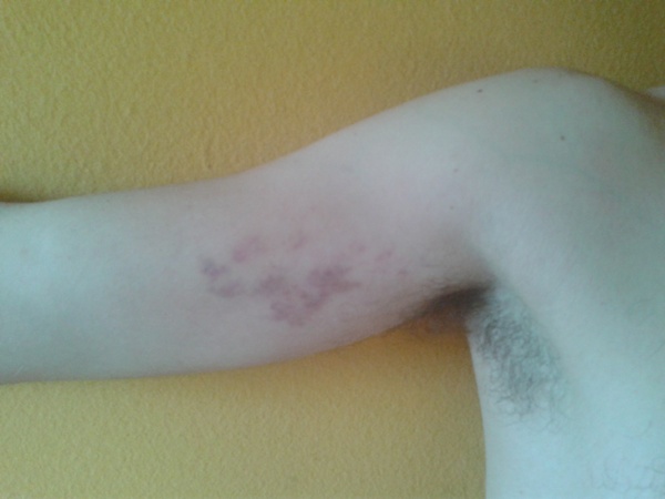 Posljedice protesta Posljedice protesta