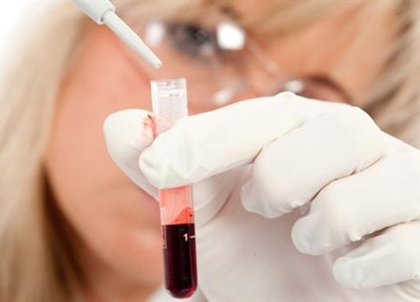 banka ko&scaron;tane srži