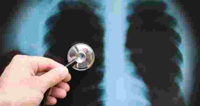 Koliko pušenje troši vašu kondiciju? Jednostavan test otkriva koliko su vam pluća pod opterećenjem