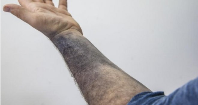 Zgranuti Splićanin: Uhvatio me pljusak, a majica poznatog modnog brenda potpuno me obojila u plavo! 