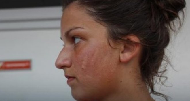 Ostali joj tragovi šake na licu: Robusni funkcioner ošamario mladu fudbalerku jer se radovala nakon pobjede!