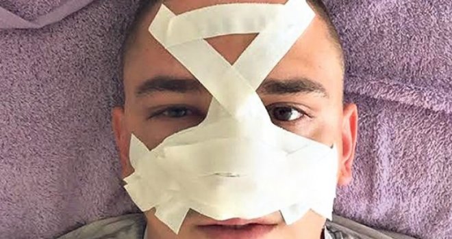 Užas u Srbiji: Pretukli DJ-a jer im nije pustio pjesmu 'Vidovdan'