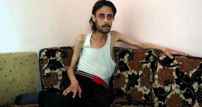 Očaj civila pod opsadom u Halepu: Tijelo mi se topi, zaboravili smo kako izgleda jabuka...