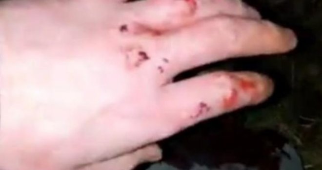 Umro 26-godišnjak čije su brutalno mučenje napadači objavili na Facebooku