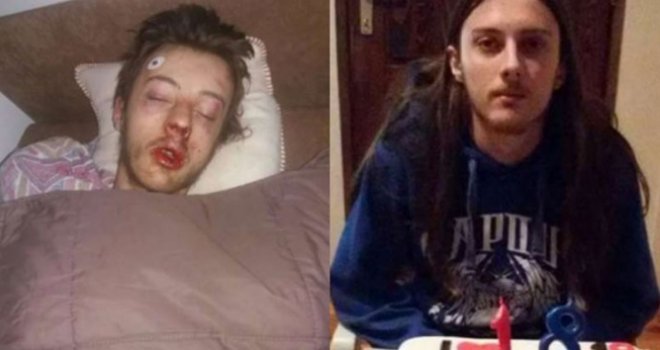 Detalji stravičnog napada u Tesliću: Bogdana Rakića tjerali da pije urin i da se baci niz liticu