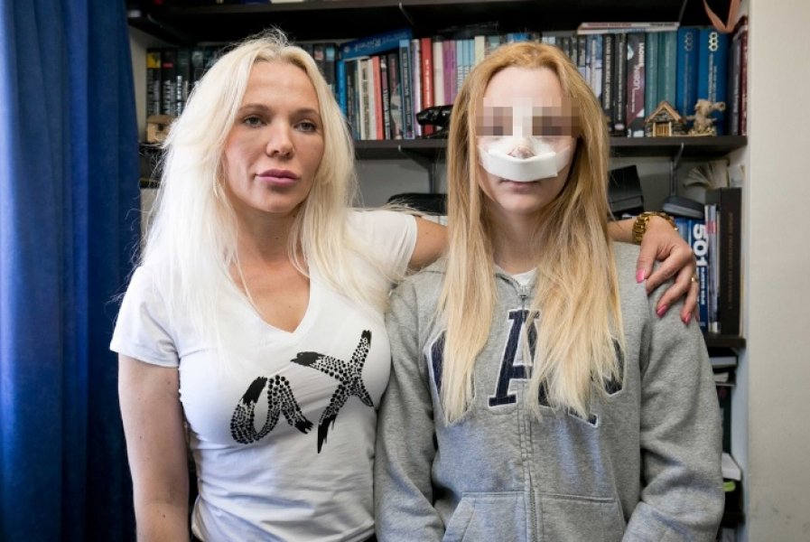 majka-i-kcerka-operacija