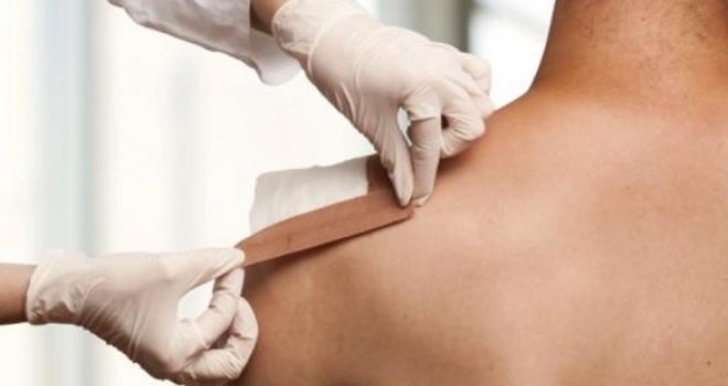 Užas u Zenici: Majka troje djece umrla nakon što je na tijelo zalijepila četiri flastera protiv bolova 