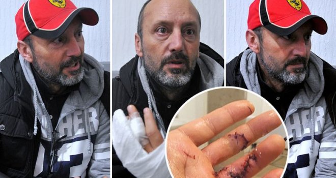 Povezao dvojicu mladića, a onda mu jedan nožem prerezao tetivu... Ne zna hoće li ikad više moći voziti...