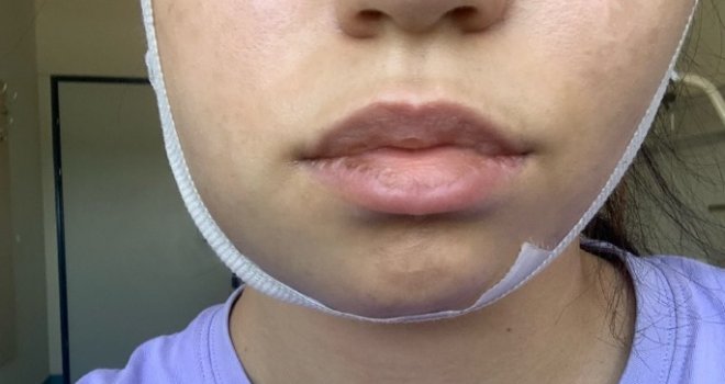 Slomio joj vilicu: Student kriminalistike pretukao bivšu djevojku u kafiću, niko od prisutnih nije reagovao