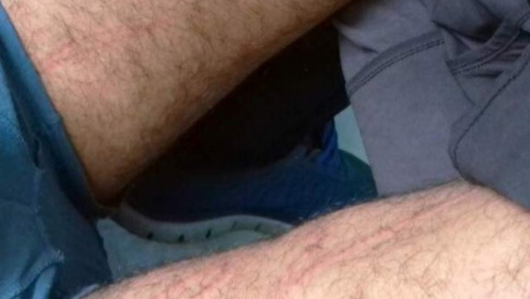 rvi-silovanje-odzak1