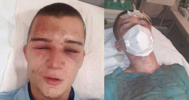 Užas u Konjicu: Brutalno pretukli 20-godišnjaka, iživljavali se i urinirali po njemu, pa ga bacili u potok