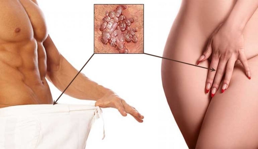 hpv-oba-pola