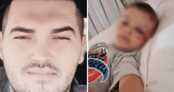Ispovijest Rijalda Hasanovića: Moje trogodišnje dijete je velikom brzinom udario motociklista u Baškoj Vodi, sada žele sve zataškati