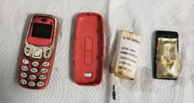 Pacijentu u Prištini ljekari izvadili mobitel iz stomaka