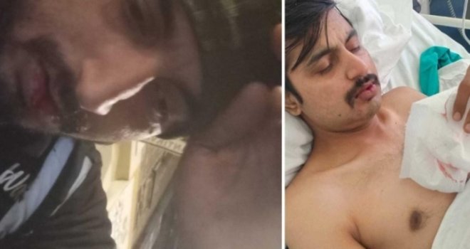 Jezivi napad na stranca u centru Zagreba, detalji su brutalni: 'Hrane me na slamku, samo sa sokom i mlijekom'